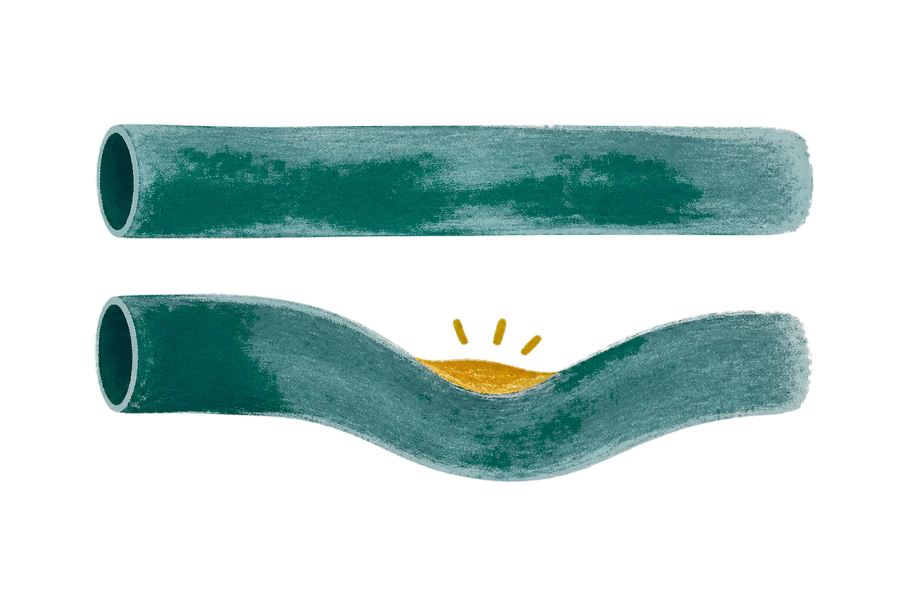 Abstract diagram showing even expansion above and restricted expansion below, where a gold plaque patch prevents one side from stretching evenly.